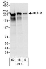 eIF4G1/eIF4GI Antibody in Western Blot (WB)