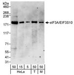 eIF3A/eIF3S10 Antibody in Western Blot (WB)
