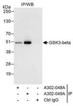 GSK3-beta Antibody in Immunoprecipitation (IP)
