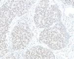 HJURP Antibody in Immunohistochemistry (Paraffin) (IHC (P))