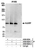 HJURP Antibody in Immunoprecipitation (IP)