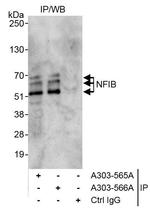 NFIB Antibody in Immunoprecipitation (IP)