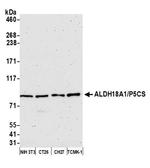 ALDH18A1/P5CS Antibody in Western Blot (WB)
