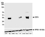 CD74 Antibody in Western Blot (WB)