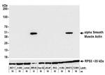 alpha Smooth Muscle Actin Antibody in Western Blot (WB)