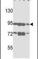 ABCB5 Antibody in Western Blot (WB)