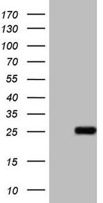 ABCC5 Antibody in Western Blot (WB)