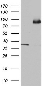 ABCD1 Antibody in Western Blot (WB)