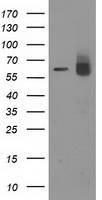 ACOT12 Antibody in Western Blot (WB)