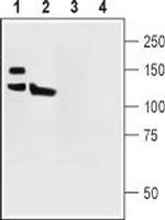 PMCA1 Antibody in Western Blot (WB)