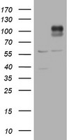 ADAMTS8 Antibody in Western Blot (WB)
