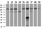 ADH1B Antibody in Western Blot (WB)