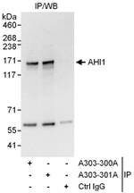 AHI1 Antibody in Immunoprecipitation (IP)