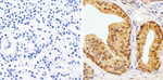 AKT1 Antibody in Immunohistochemistry (Paraffin) (IHC (P))