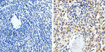 FAK Antibody in Immunohistochemistry (Paraffin) (IHC (P))