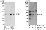 AIDA Antibody in Western Blot (WB)