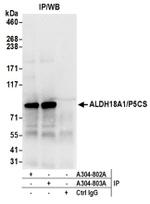 ALDH18A1/P5CS Antibody in Western Blot (WB)