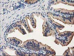ALDH1A3 Antibody in Immunohistochemistry (Paraffin) (IHC (P))