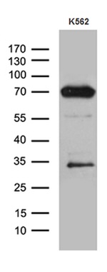 ALOX5 Antibody in Western Blot (WB)