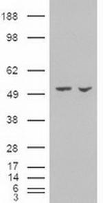 AMY2A Antibody in Western Blot (WB)