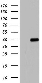 ANGPT1 Antibody in Western Blot (WB)