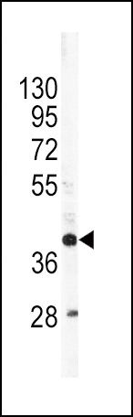 Apolipoprotein L1 Antibody in Western Blot (WB)