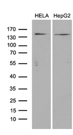 ARHGEF18 Antibody in Western Blot (WB)