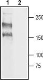 NaV1.8 (SCN10A) Antibody in Western Blot (WB)
