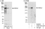 ASXL2 Antibody in Western Blot (WB)