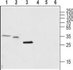 TRIC-A (TMEM38A) Antibody in Western Blot (WB)