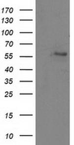 ATP6V1B1 Antibody in Western Blot (WB)