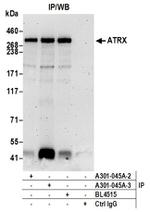ATRX Antibody in Western Blot (WB)