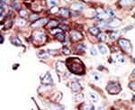 Axl Antibody in Immunohistochemistry (Paraffin) (IHC (P))