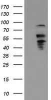 B3GNT2 Antibody in Western Blot (WB)