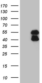 BCL7B Antibody in Western Blot (WB)
