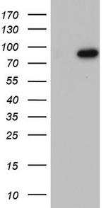 BFSP1 Antibody in Western Blot (WB)