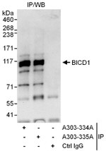 BICD1 Antibody in Immunoprecipitation (IP)