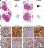 CD44var (v6) Antibody in Immunohistochemistry (IHC)