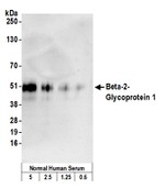Beta-2-Glycoprotein 1 Antibody in Western Blot (WB)