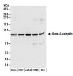 Beta-2-adaptin Antibody in Western Blot (WB)