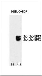 Phospho-ERK1 (Thr202, Tyr205) Antibody in Western Blot (WB)
