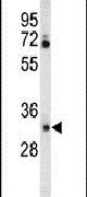 Carbonic Anhydrase VI Antibody in Western Blot (WB)