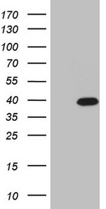 CABP4 Antibody in Western Blot (WB)
