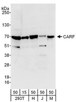 CARF Antibody in Western Blot (WB)