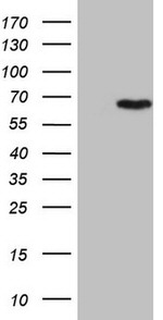 CCDC36 Antibody in Western Blot (WB)
