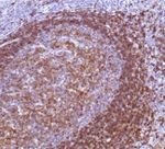 CD22 Antibody in Immunohistochemistry (Paraffin) (IHC (P))