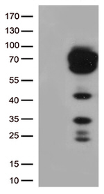 CD5 Antibody in Western Blot (WB)