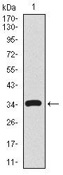 CD59 Antibody in Western Blot (WB)