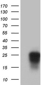 CD63 Antibody in Western Blot (WB)
