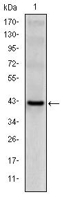 CD94 Antibody in Western Blot (WB)